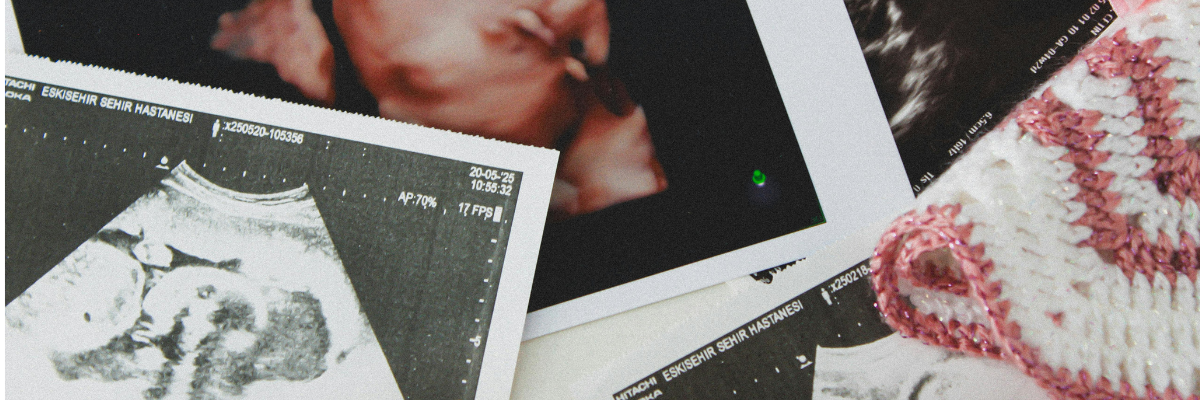 Uncertainty With Purpose: Why Prenatal Carrier Screening Should Report VUSs